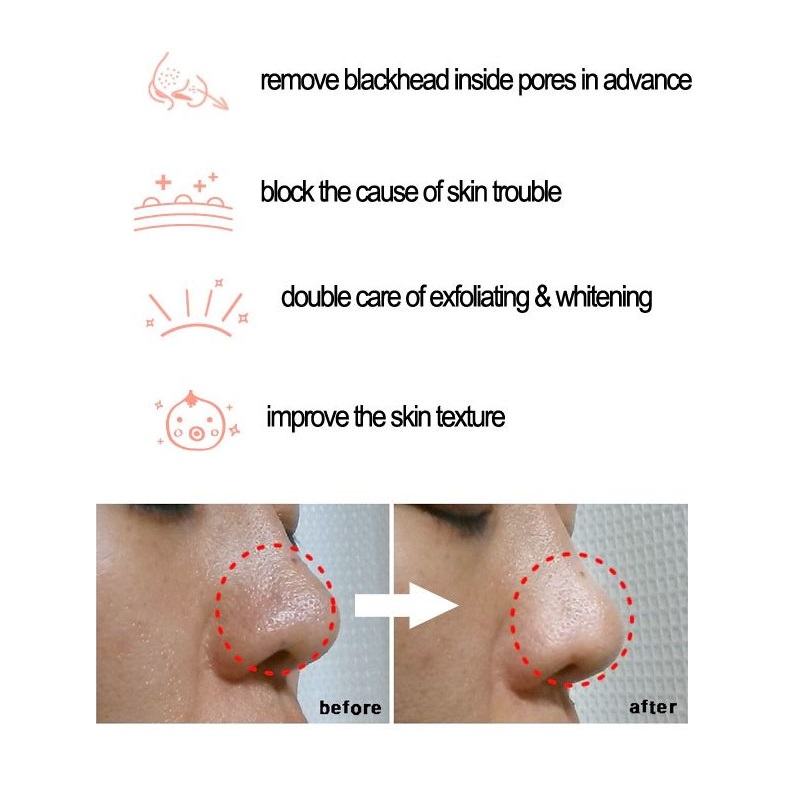 Cosrx BHA siyah nokta güç sıvı - Skincare Cosrx incelemesi ve fiyatı